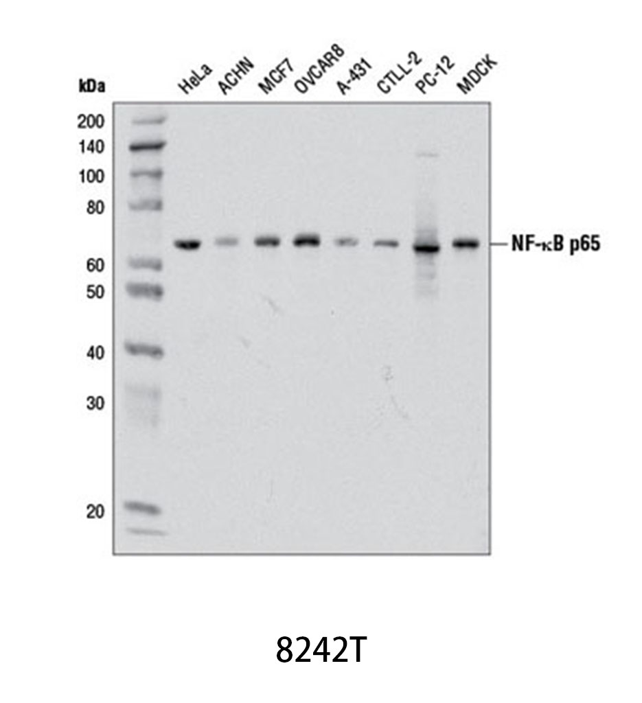 NF-κB p65 (D14E12) XP Rabbit mAb