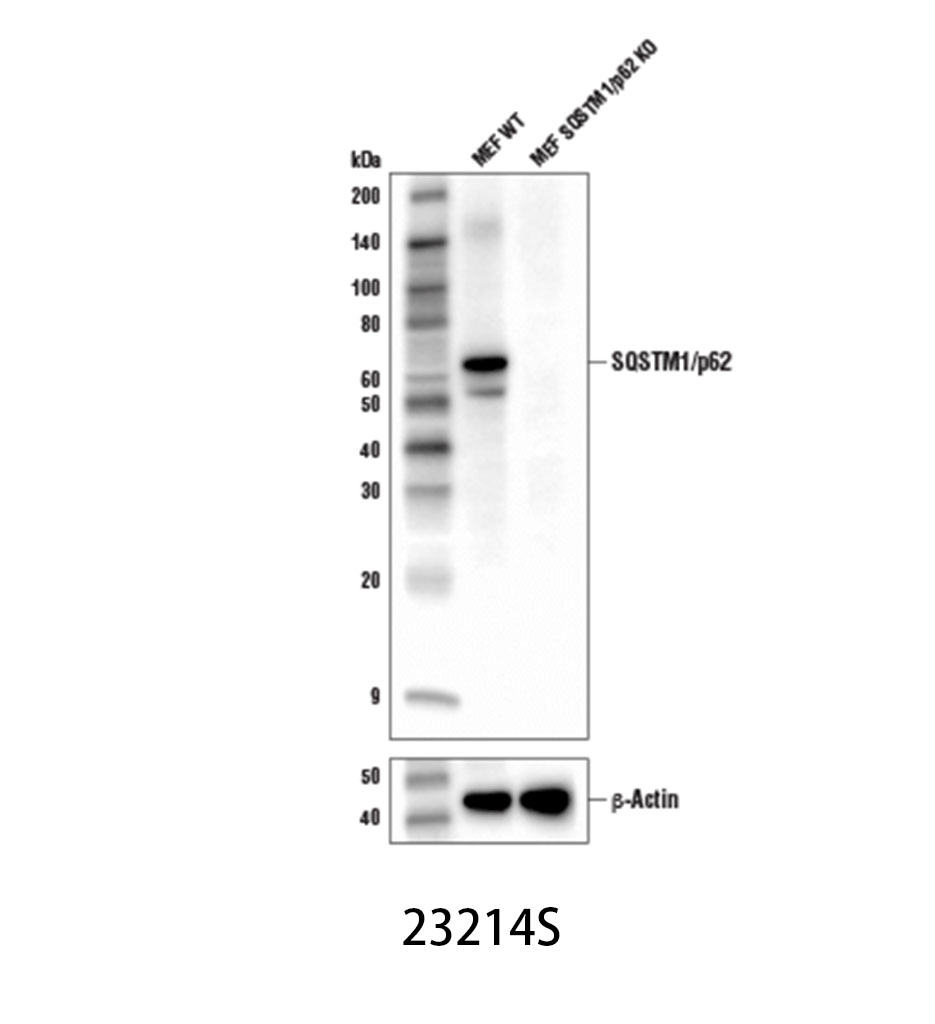 SQSTM1/p62 (D6M5X) Rabbit mAb (Rodent Specific)