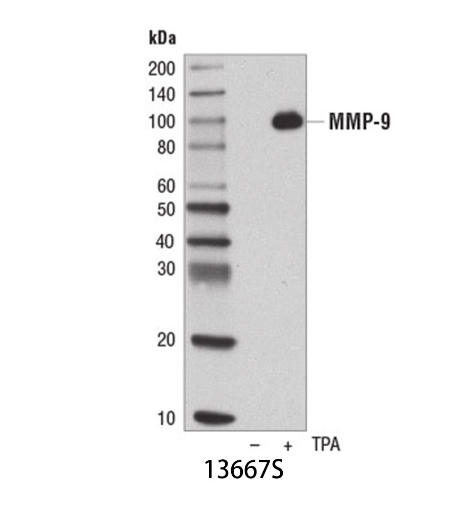 MMP-9 (D6O3H) XP Rabbit mAb