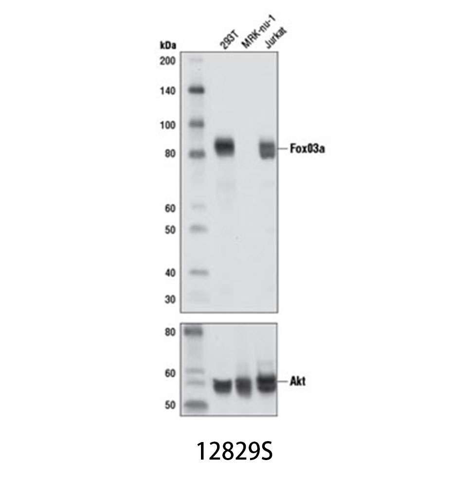 FoxO3a (D19A7) Rabbit mAb