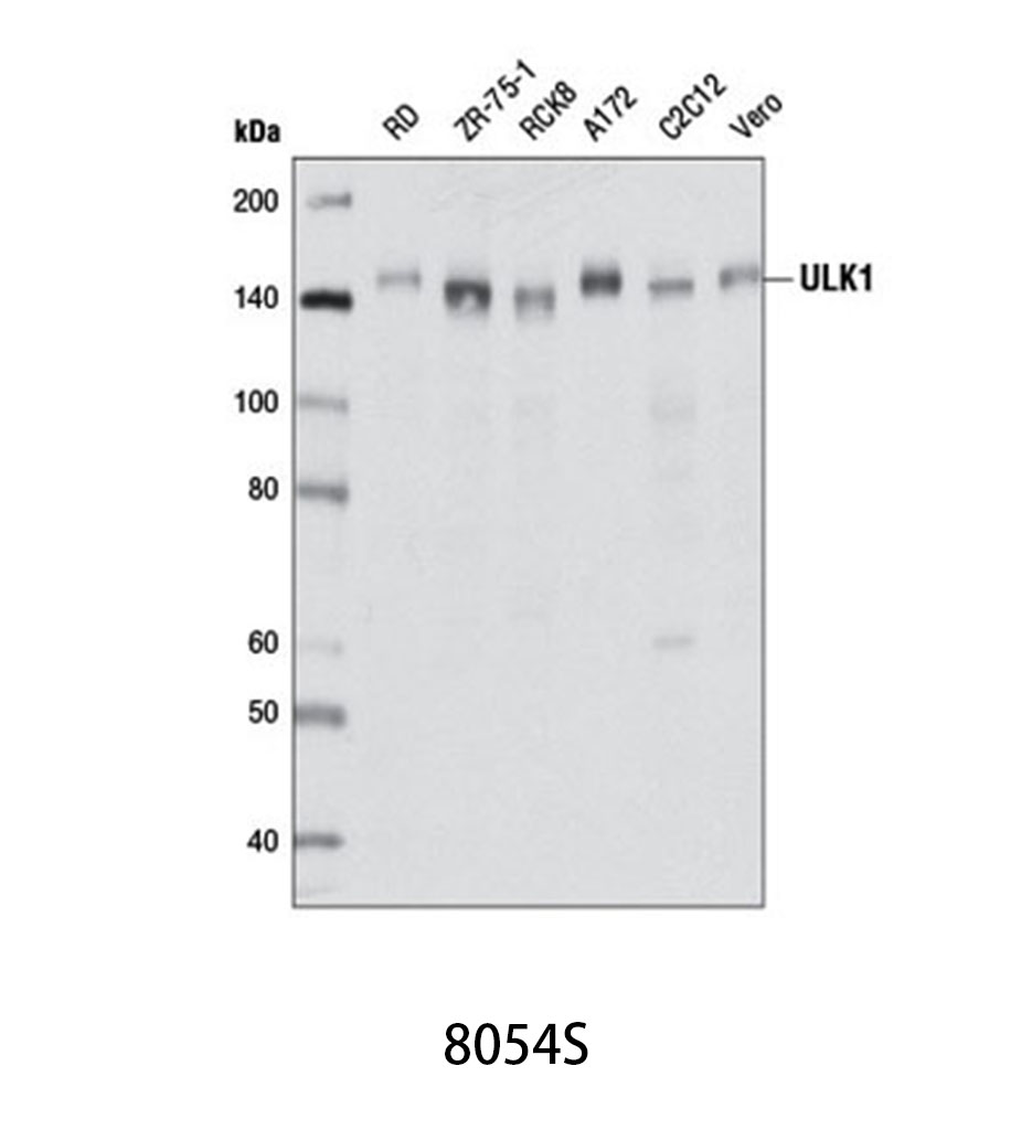 ULK1 (D8H5) Rabbit mAb