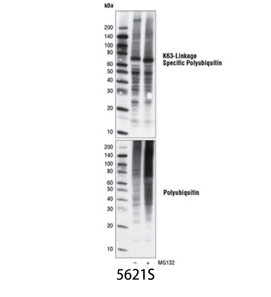 K63-linkage Specific Polyubiquitin (D7A11) Rabbit mAb