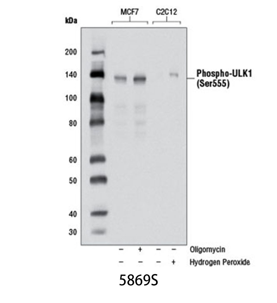 Phospho-ULK1 (Ser555) (D1H4) Rabbit mAb