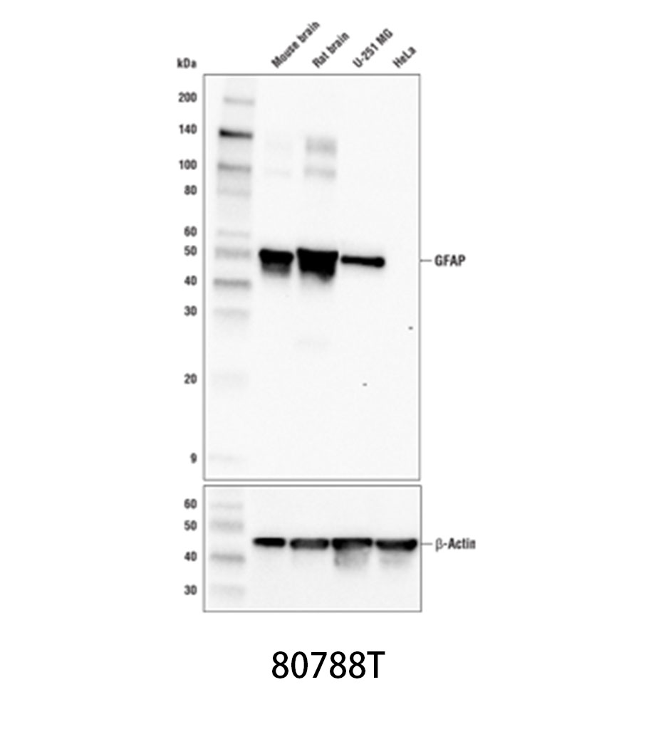 GFAP (E4L7M) XP Rabbit mAb
