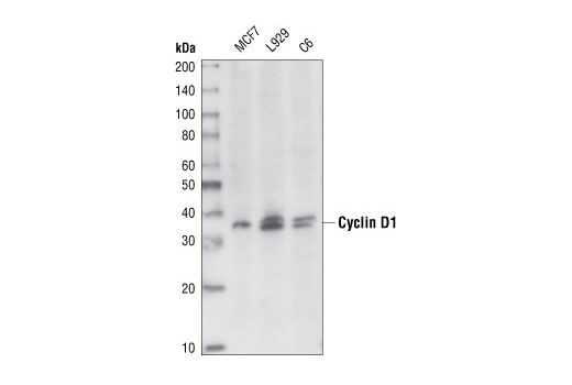 Cyclin D1 (92G2) Rabbit mAb