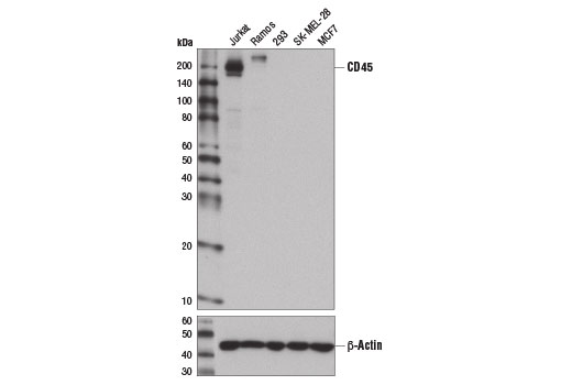 CD45 (D9M8I) XP Rabbit mAb