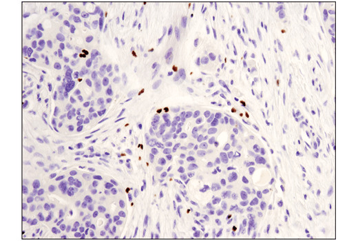 FoxP3 (D2W8E) Rabbit mAb (IHC Specific)