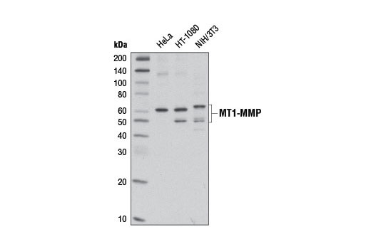 Matrix Remodeling Antibody Sampler Kit