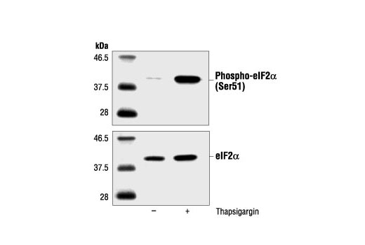 Phospho-eIF2α (Ser51) Antibody