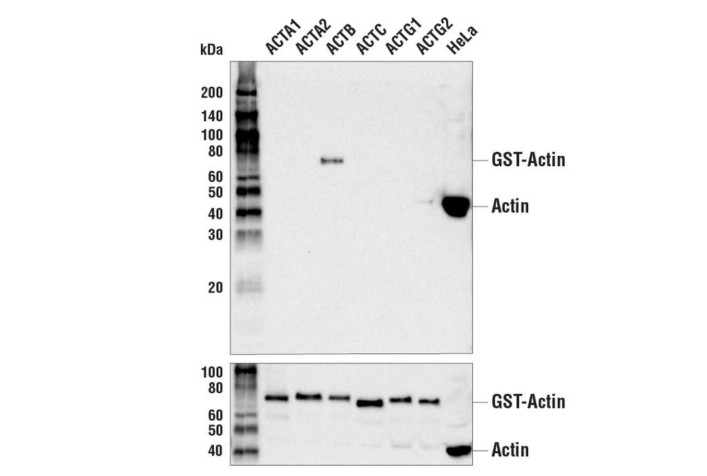 β-Actin (13E5) Rabbit mAb