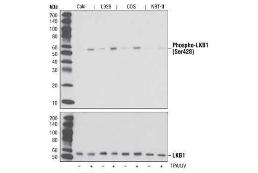 Phospho-LKB1 (Ser428) (C67A3) Rabbit mAb