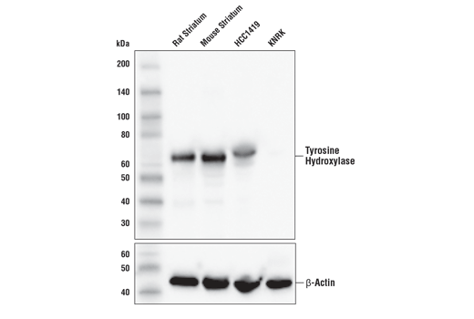 Tyrosine Hydroxylase (E2L6M) Rabbit mAb