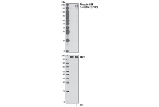 EGF Receptor Antibody