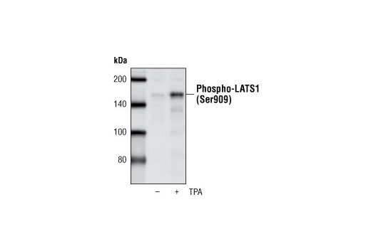 Phospho-LATS1 (Ser909) Antibody