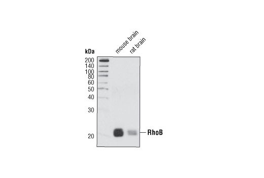 Rho-GTPase Antibody Sampler Kit