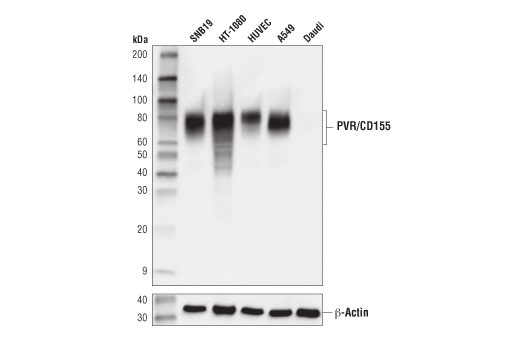 PVR/CD155 (D8A5G) Rabbit mAb