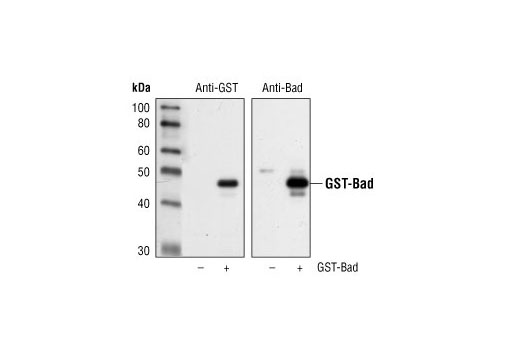 GST (91G1) Rabbit mAb