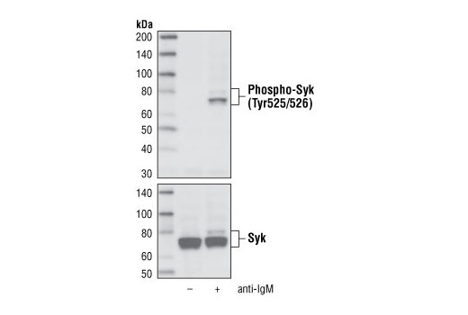Phospho-Syk (Tyr525/526) (C87C1) Rabbit mAb