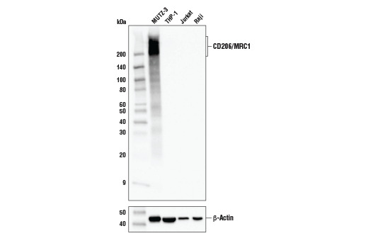 CD206/MRC1 (E2L9N) Rabbit mAb