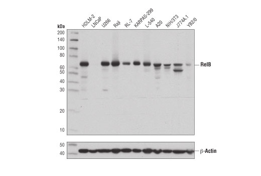 NF-κB Family Antibody Sampler Kit II