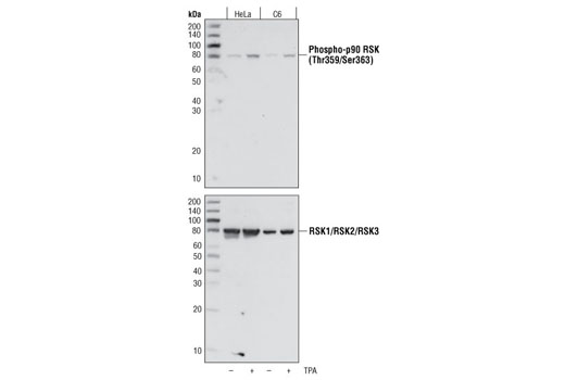 Phospho-p90RSK (Thr359/Ser363) Antibody