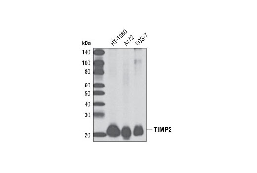 TIMP2 (D18B7) Rabbit mAb