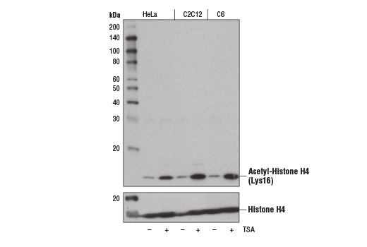Acetyl-Histone H4 (Lys16) (E2B8W) Rabbit mAb