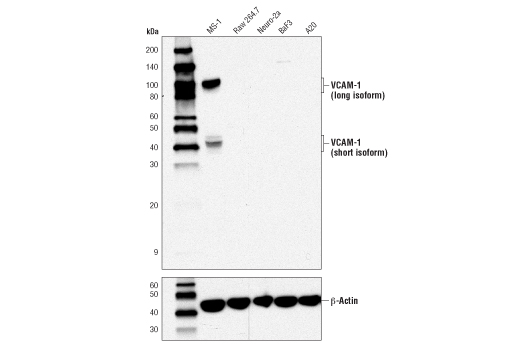 VCAM-1 (D8U5V) Rabbit mAb (Mouse Specific)
