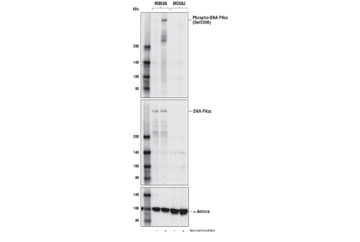 Phospho-DNA-PKcs (Ser2056) (E9J4G) Rabbit mAb