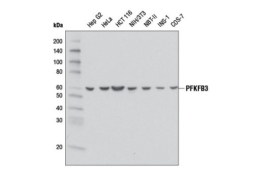 PFKFB3 (D7H4Q) Rabbit mAb