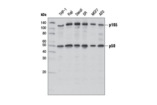 NF-κB Family Member Antibody Sampler Kit