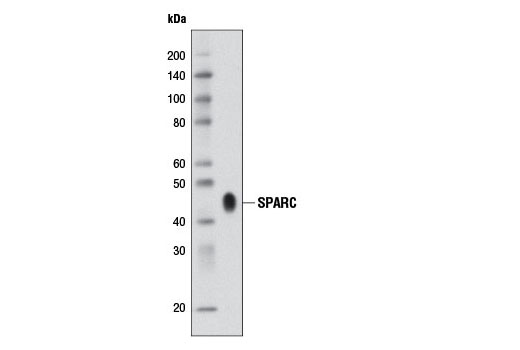 SPARC (D10F10) Rabbit mAb