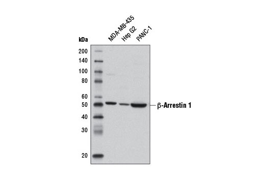 β-Arrestin 1 (D8O3J) Rabbit mAb