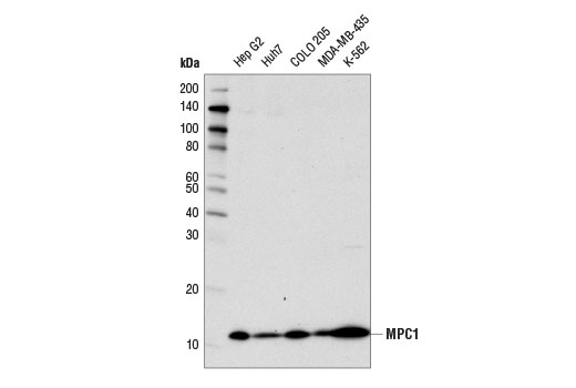 MPC1 (D2L9I) Rabbit mAb