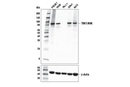 TBK1/NAK (E9H5S) Mouse mAb