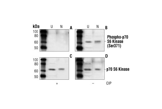 Phospho-p70 S6 Kinase (Ser371) Antibody