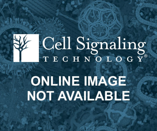 Mouse Brain Tissue Control Extracts