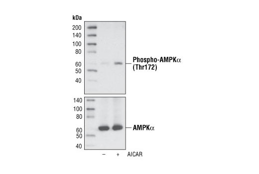 Phospho-AMPKα (Thr172) (D79.5E) Rabbit mAb