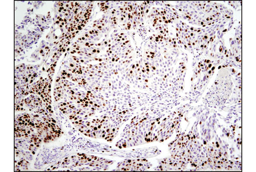 Ki-67 (D2H10) Rabbit mAb (IHC Specific)