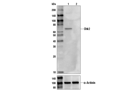 Chk2 (1C12) Mouse mAb