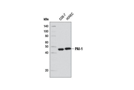 PAI-1 (D9C4) Rabbit mAb