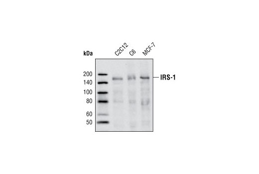 IRS-1 (59G8) Rabbit mAb