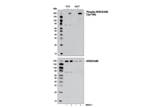 Phospho-HER2/ErbB2 (Tyr1196) (D66B7) Rabbit mAb