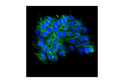 E-Cadherin (24E10) Rabbit mAb (Alexa Fluor 488 Conjugate)