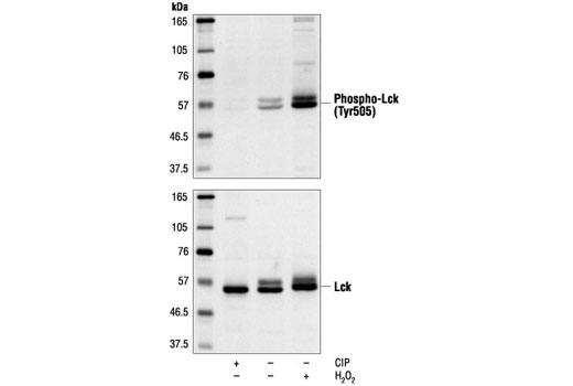 Phospho-Lck (Tyr505) Antibody