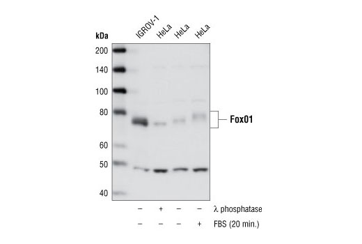 FoxO1 (L27) Antibody