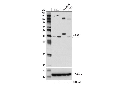 OAS1 (D1W3A) Rabbit mAb