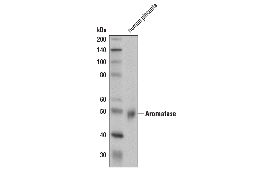 Aromatase (D5Q2Y) Rabbit mAb