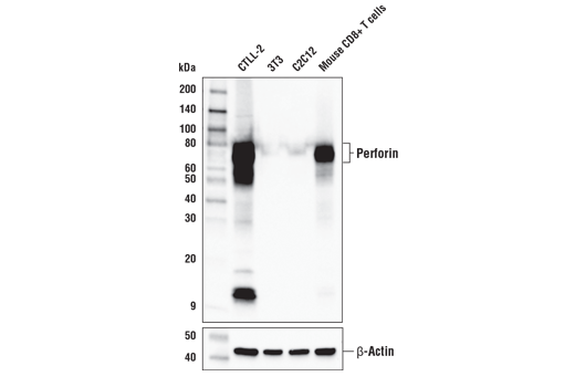 Perforin (E3W4I) Rabbit mAb