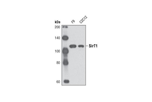 SirT1 (D60E1) Rabbit mAb (Mouse Specific)